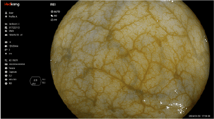 NEI Imaging