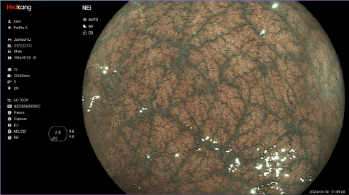 REI Imaging